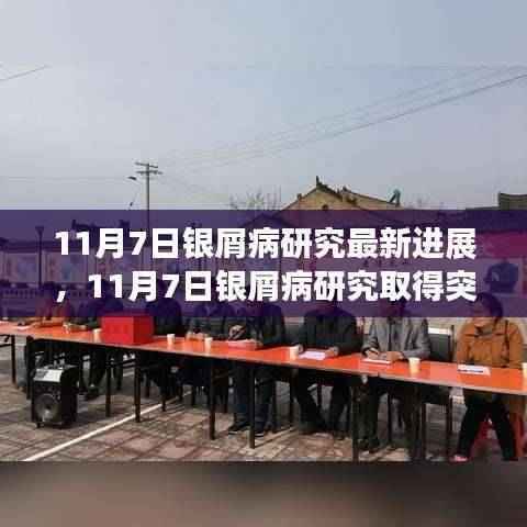 11月7日银屑病研究取得重大突破性进展新发现